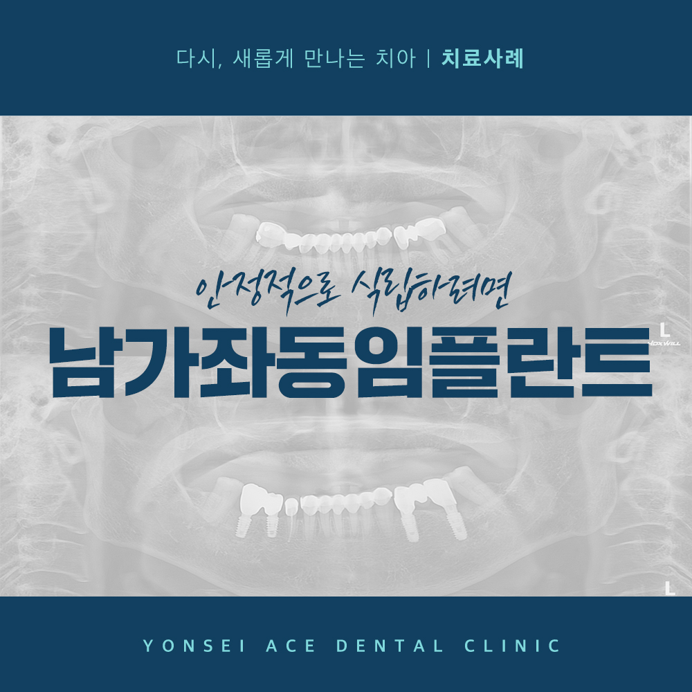 남가좌동임플란트