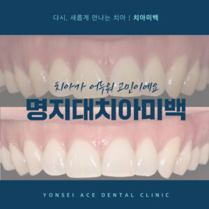 명지대치아미백