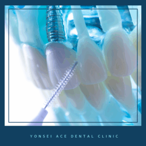 남가좌동임플란트