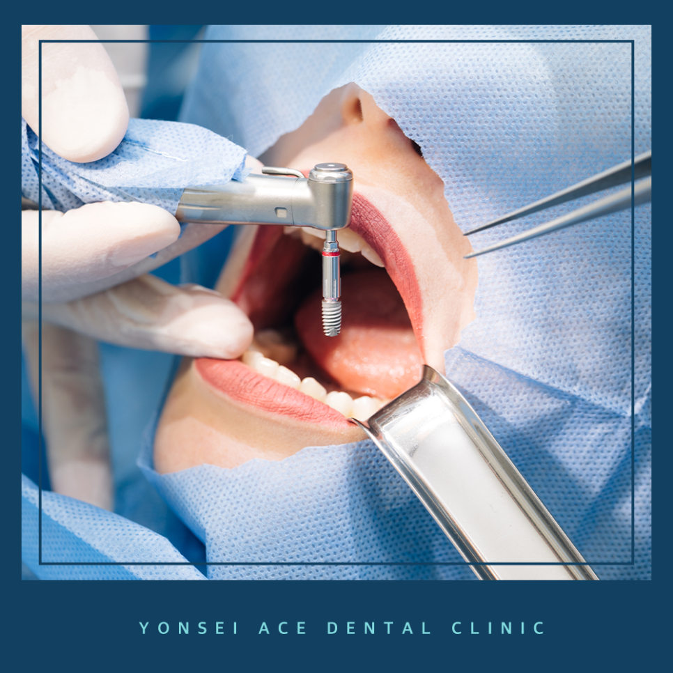 서대문구임플란트