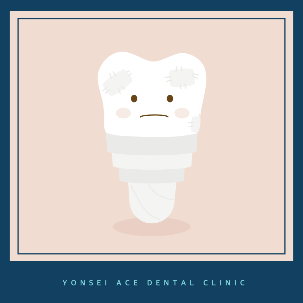 서대문구임플란트