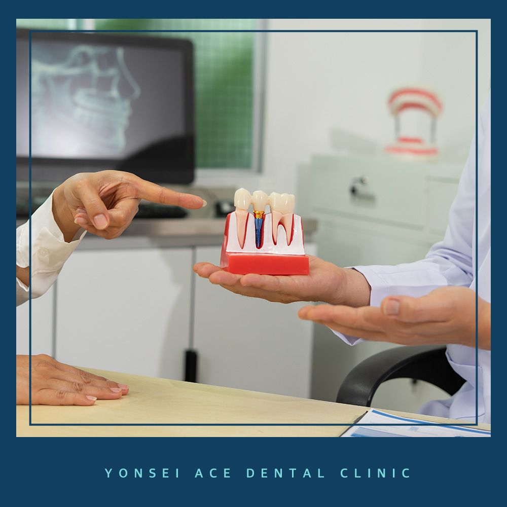 서대문구임플란트