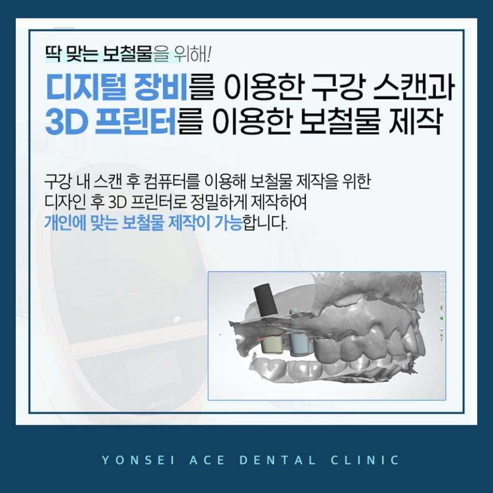 서대문구임플란트