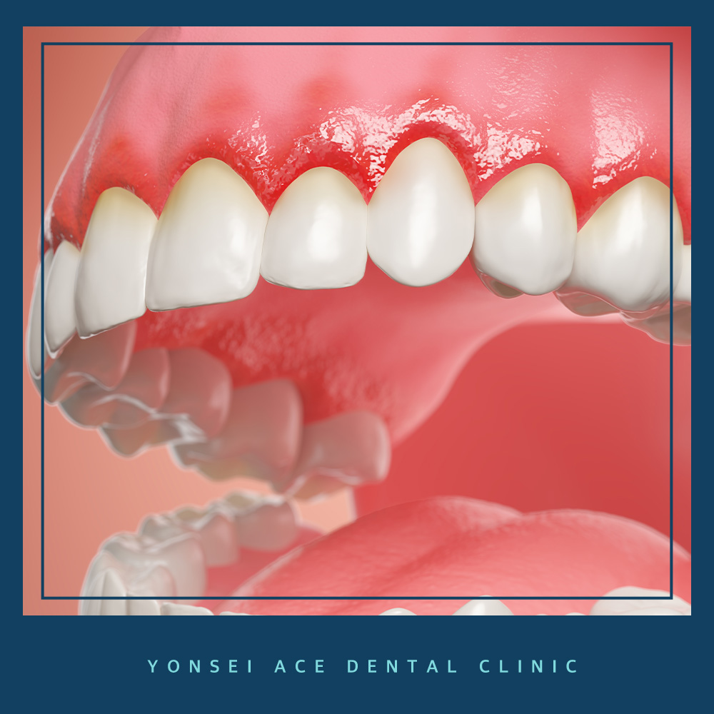 서대문구임플란트