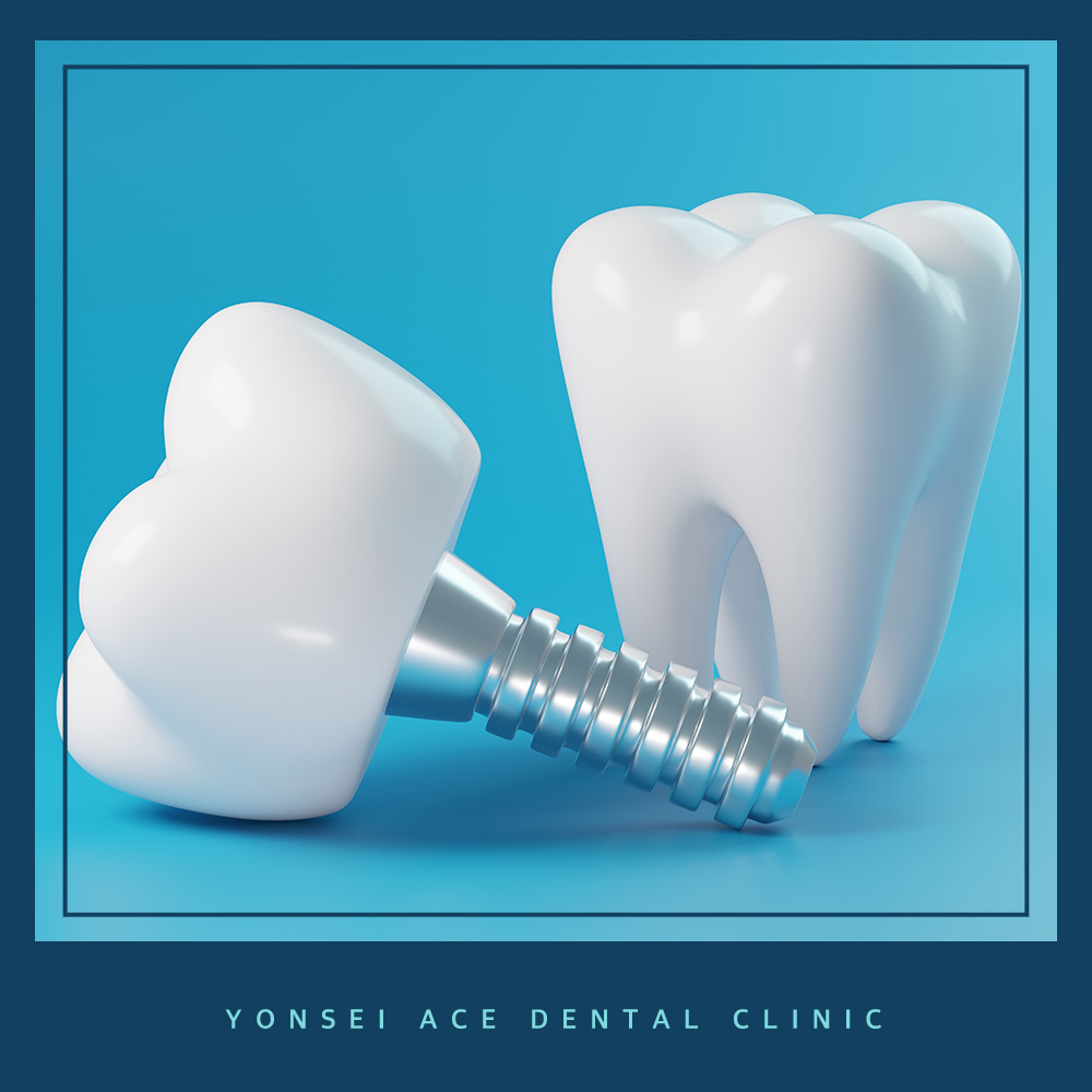 서대문구임플란트