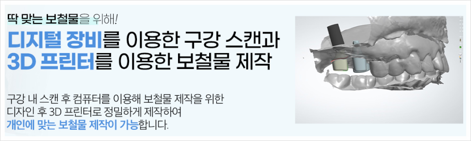 서대문구임플란트