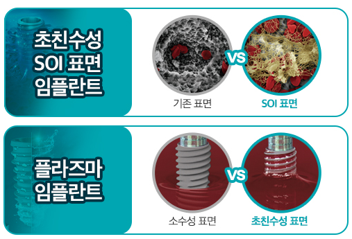 서대문구임플란트