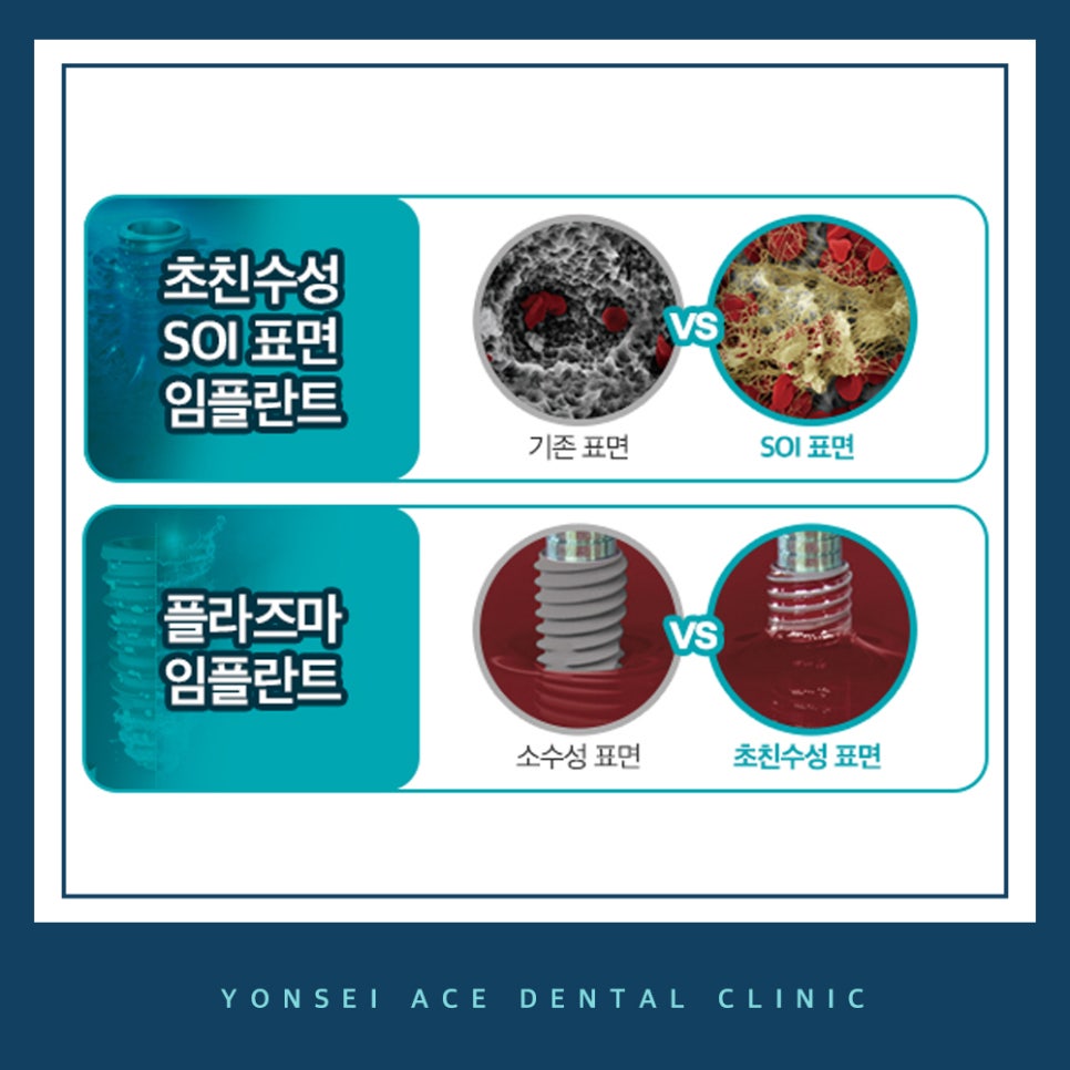 서대문구임플란트